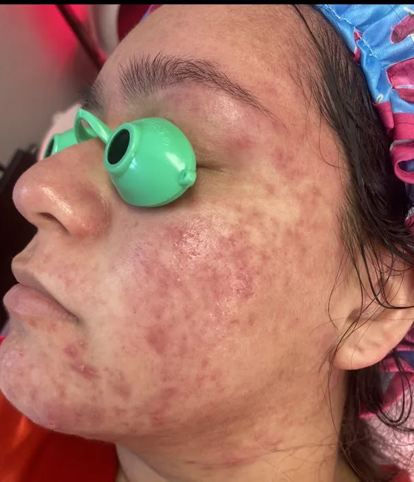 5 Years Younger Picture 7