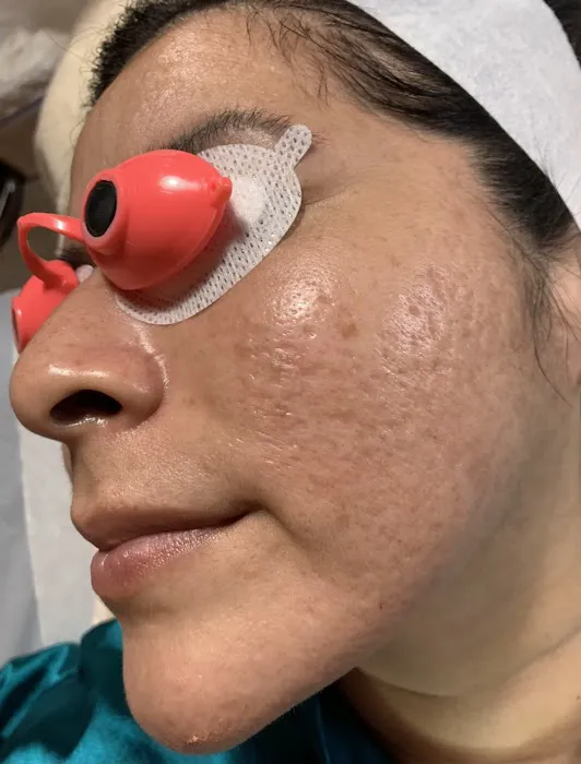 5 Years Younger Picture 8