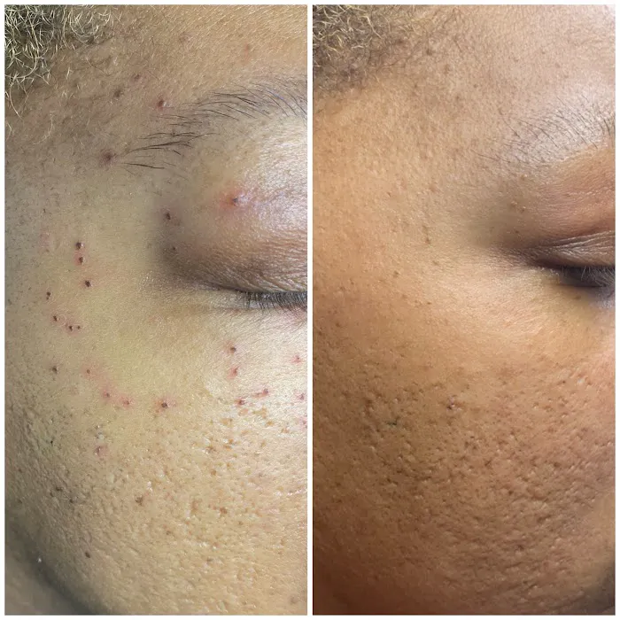 Sugar Glow Esthetics and Wellness LLC Picture 3