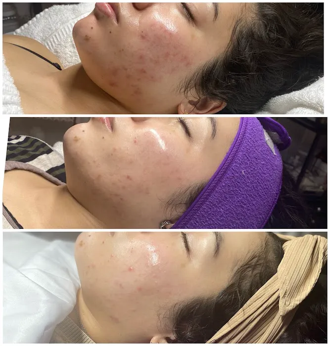 Sugar Glow Esthetics and Wellness LLC Picture 8