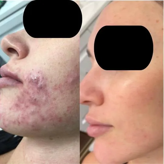 Silk Skin Laser Spa Picture 2