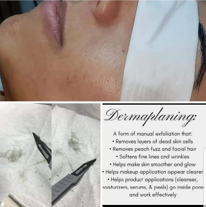 LV Skin and Laser Picture 2