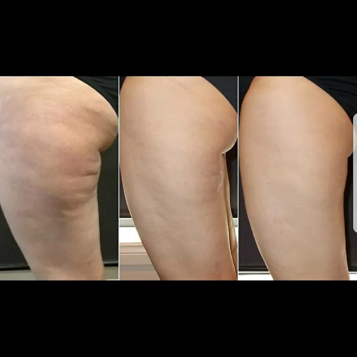 LV Skin and Laser Picture 4