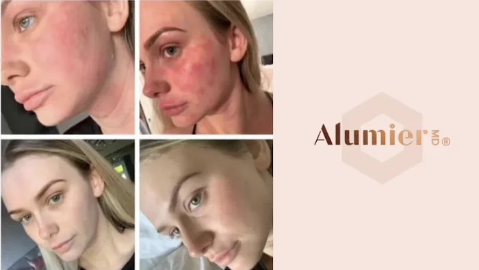 Aesthetician Elyse Picture 5