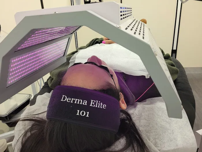 Derma Elite 101 Picture 3