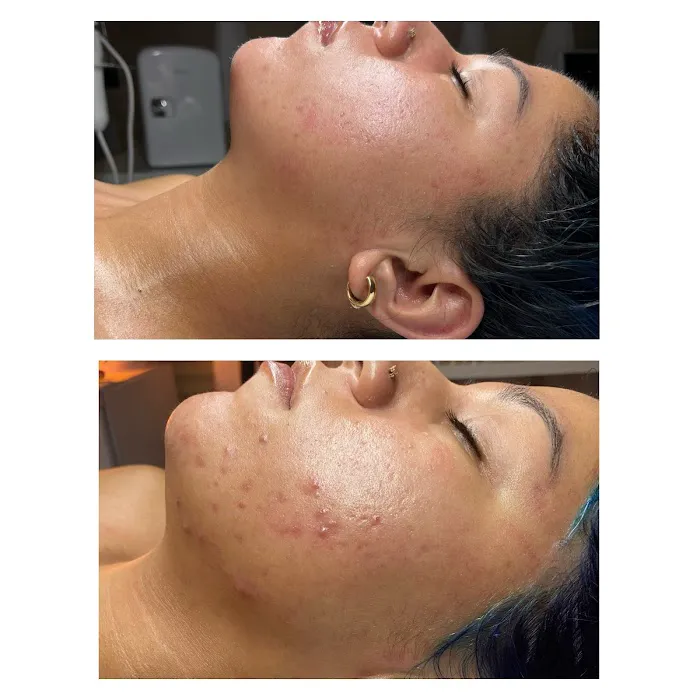 Tre Aesthetics Picture 2