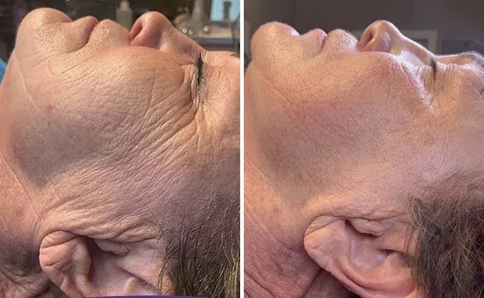 Tre Aesthetics Picture 5