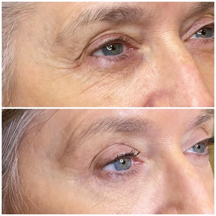 Tre Aesthetics Picture 9