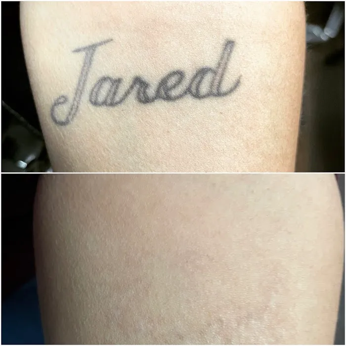 TruCanvas Aesthetics Picture 4