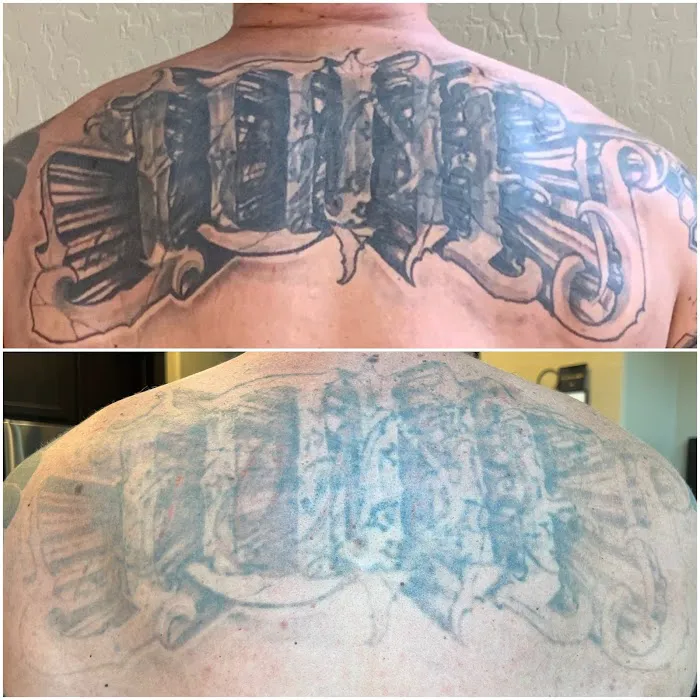 TruCanvas Aesthetics Picture 1