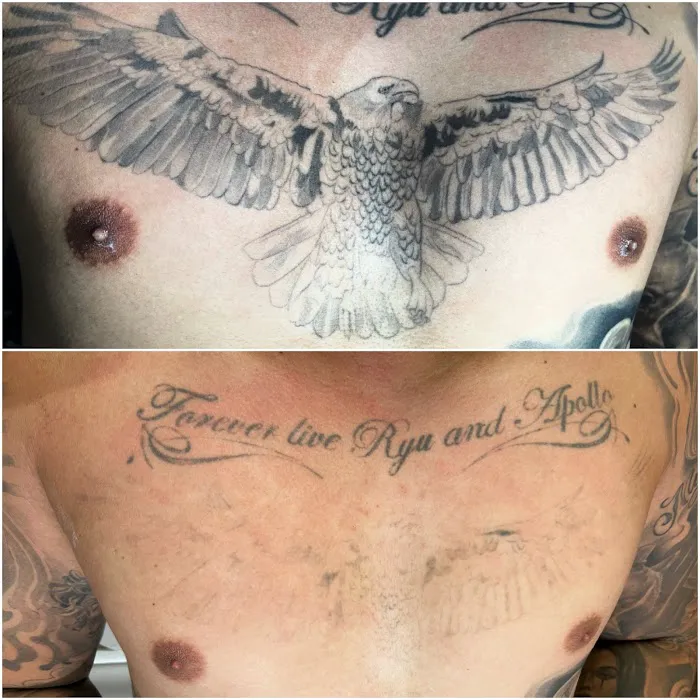 TruCanvas Aesthetics Picture 6