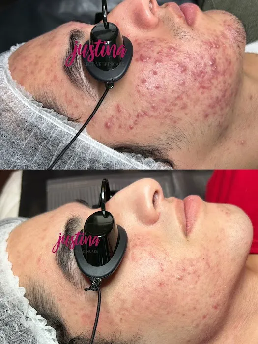 Acne Clinic Las Vegas by Justina Picture 1