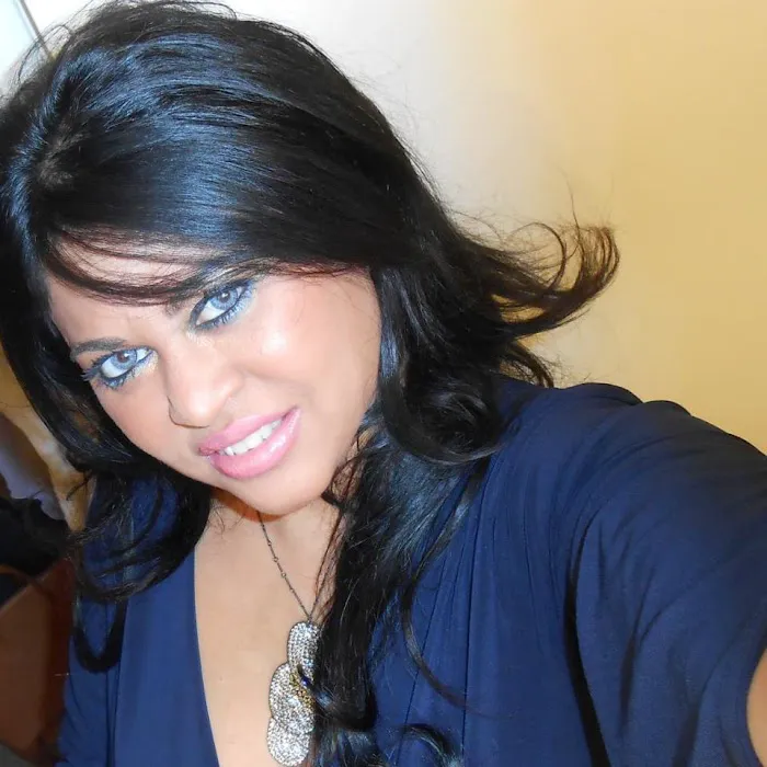 Vanity Skin Tightening Picture 4