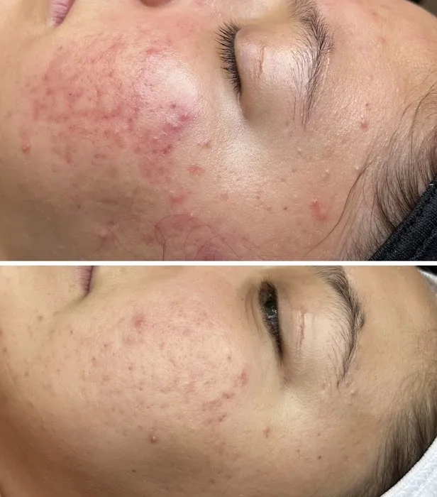 Slate Skin Aesthetics Picture 2