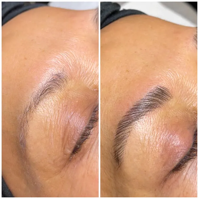 Slate Skin Aesthetics Picture 7