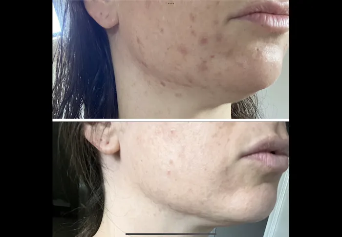 Slate Skin Aesthetics Picture 9