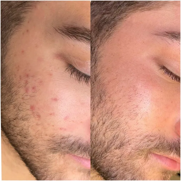 Slate Skin Aesthetics Picture 5