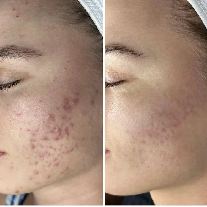 Slate Skin Aesthetics Picture 6