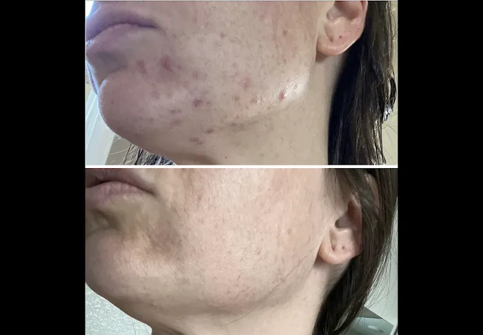 Slate Skin Aesthetics Picture 8