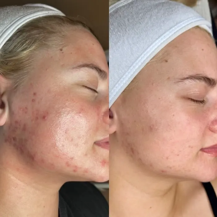 ALISKIN ESTHETICS Picture 3