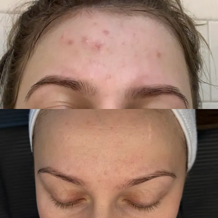 ALISKIN ESTHETICS Picture 4