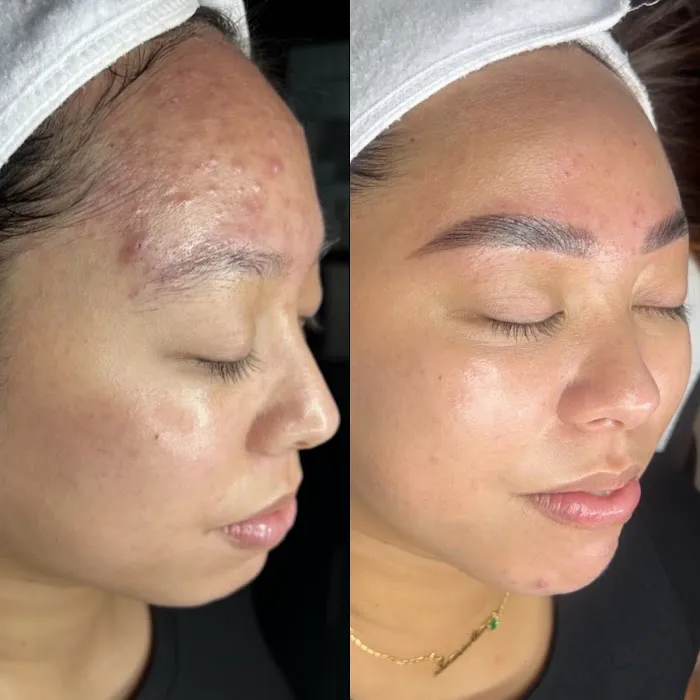 ALISKIN ESTHETICS Picture 8