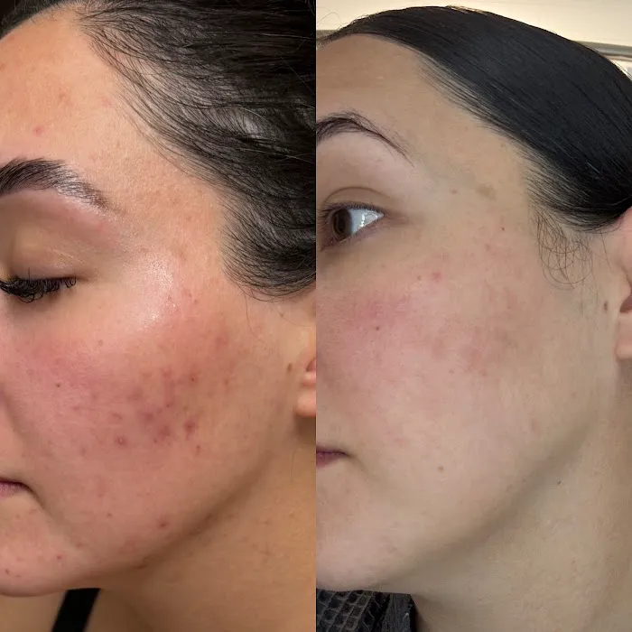 ALISKIN ESTHETICS Picture 9