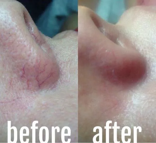 Roxanne Werly Advanced Esthetician Picture 1