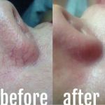 Roxanne Werly Advanced Esthetician