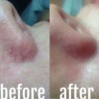 Roxanne Werly Advanced Esthetician ico