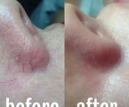 Roxanne Werly Advanced Esthetician