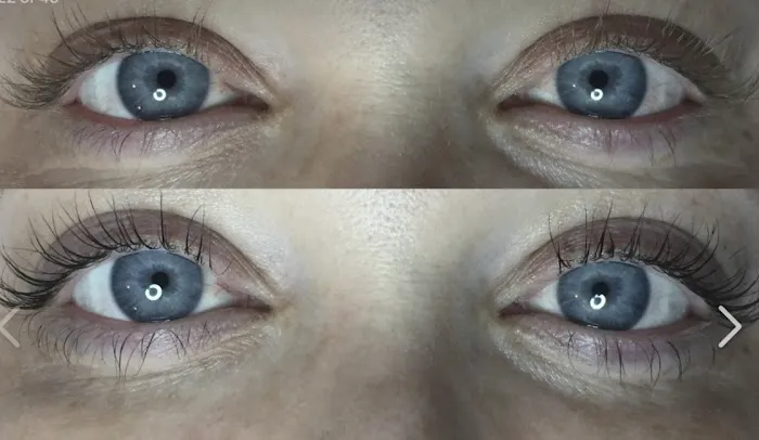 Aly’s Skincare Picture 3