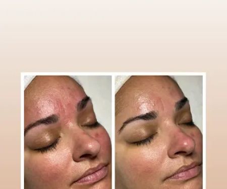 SKIN etc. by Tessa Martinez