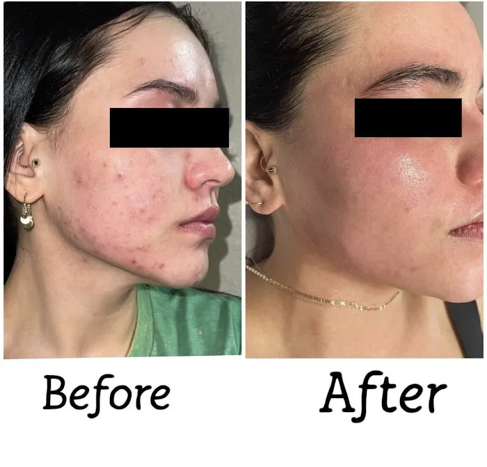 Skin Positive Picture 4