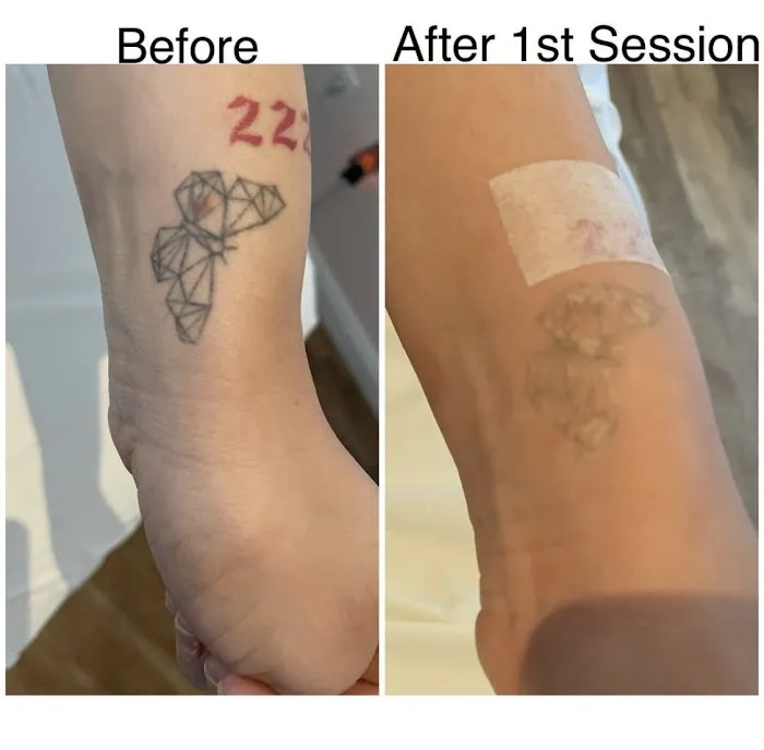 Skin Positive Picture 1