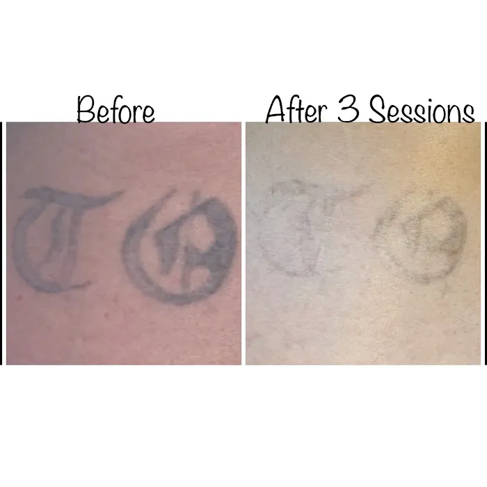 Skin Positive Picture 3