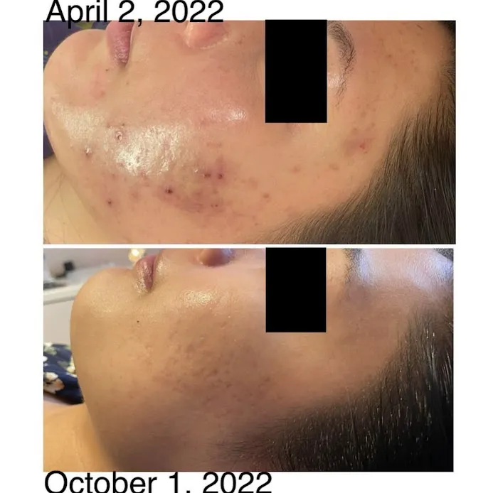 Skin Positive Picture 7