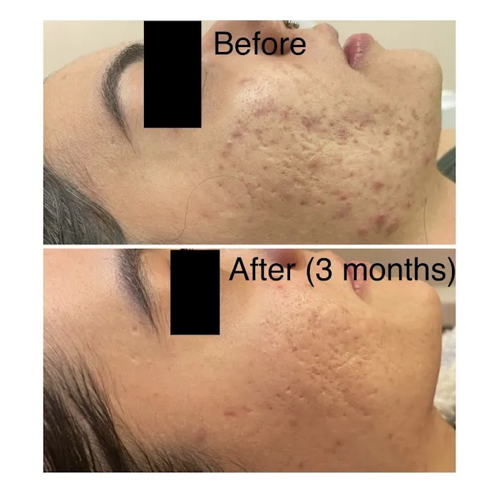 Skin Positive Picture 8