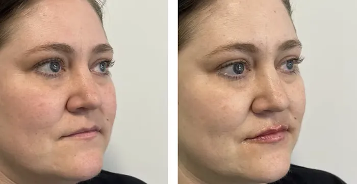 Genesis Lifestyle Medicine Picture 9