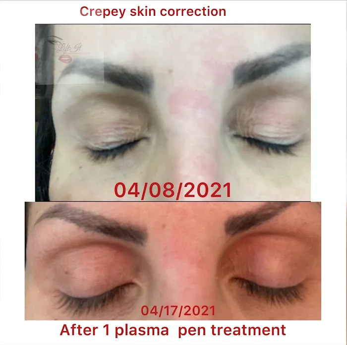 Lift It Beauty Bar Picture 2