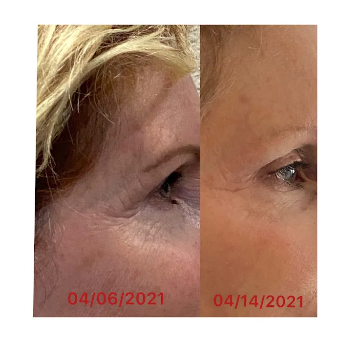 Lift It Beauty Bar Picture 4