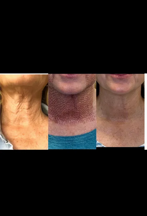 Lift It Beauty Bar Picture 5