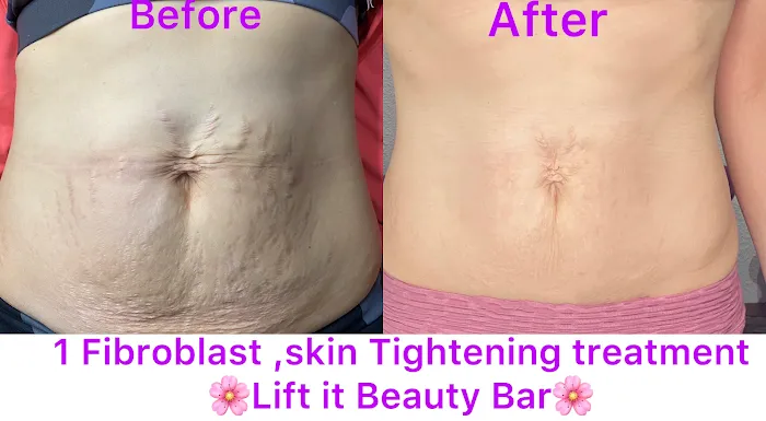 Lift It Beauty Bar Picture 6