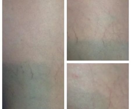 Las Vegas Laser Skin Care