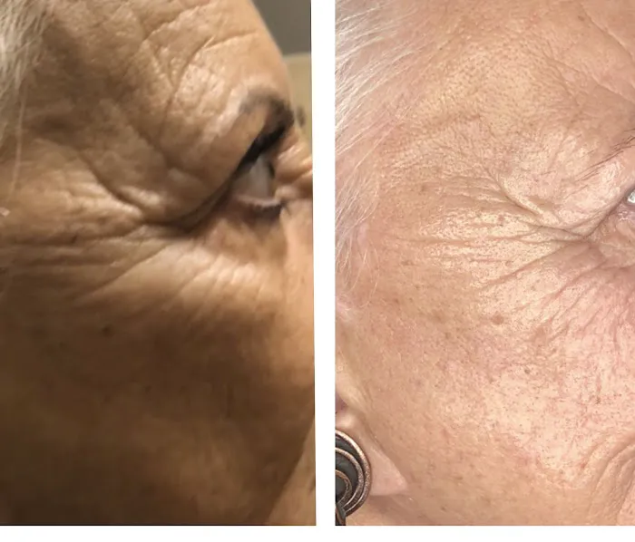 Zen Skin Skin Care MedSpa Picture 4