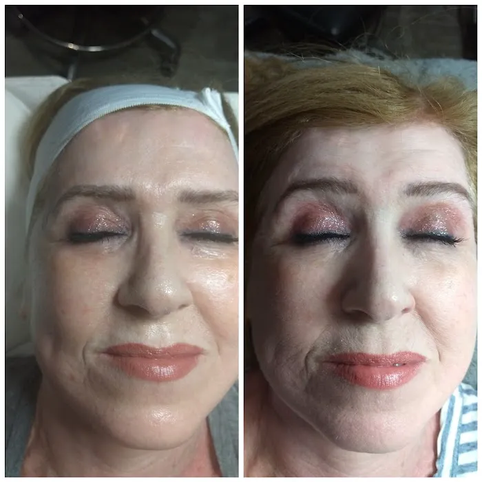 Suzee Skin Picture 1