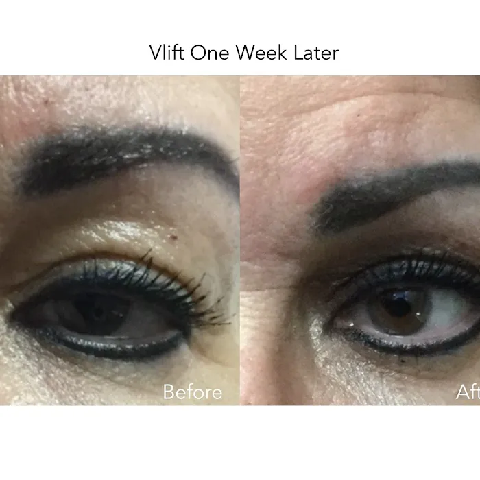 Suzee Skin Picture 3