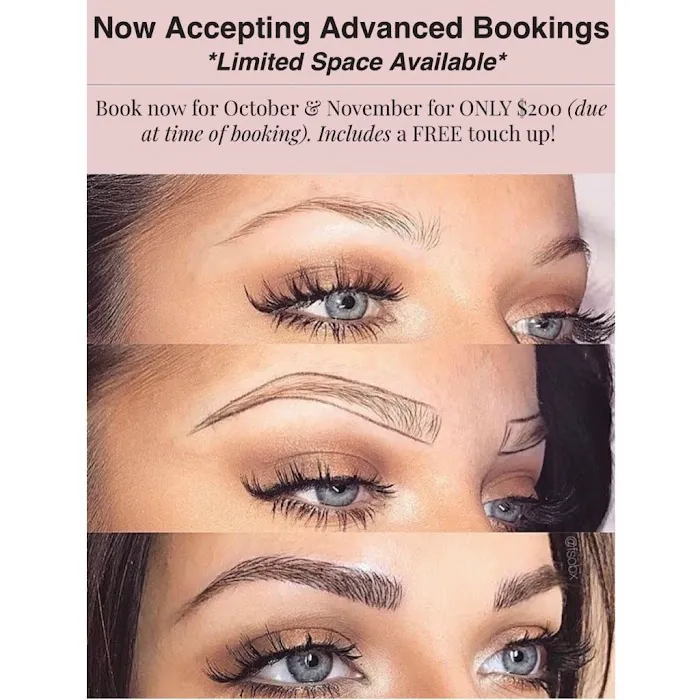 Suzee Skin Picture 2