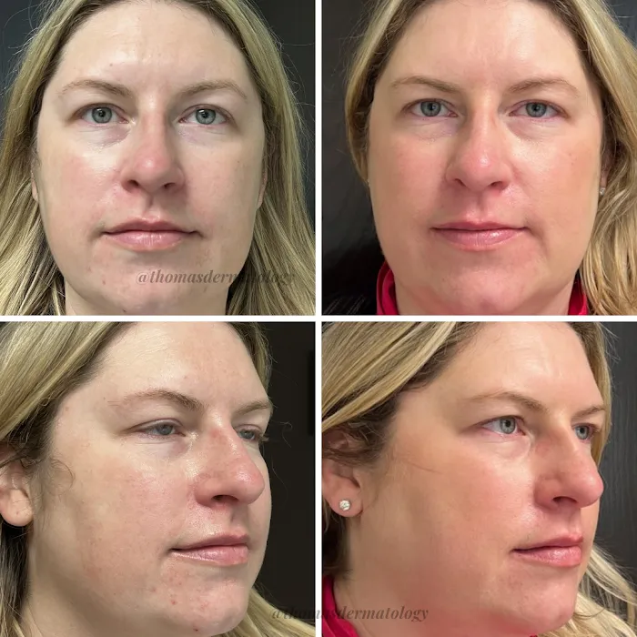 Thomas Dermatology Picture 5