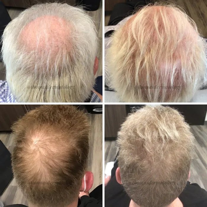 Thomas Dermatology Picture 6